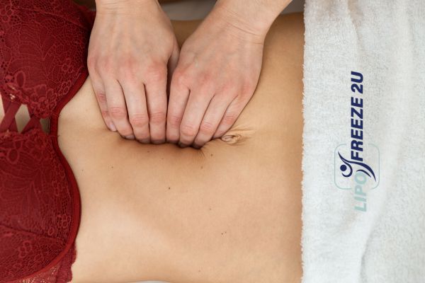 diastasis recti treatment Telford