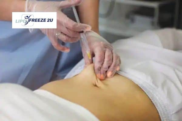 How Does Aqualyx Fat Dissolving Injection Work to Break Down Fat Telford?