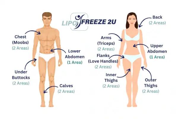 Areas you can have fat freezing treatment Telford