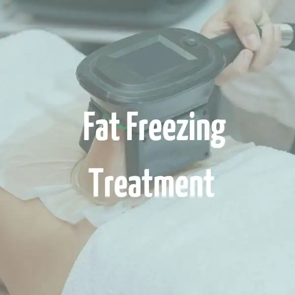 fat freezing treatment Telford