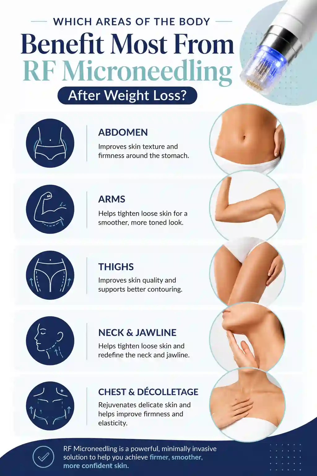 Which Areas of the Body Benefit Most From RF Microneedling After Weight Loss Telford